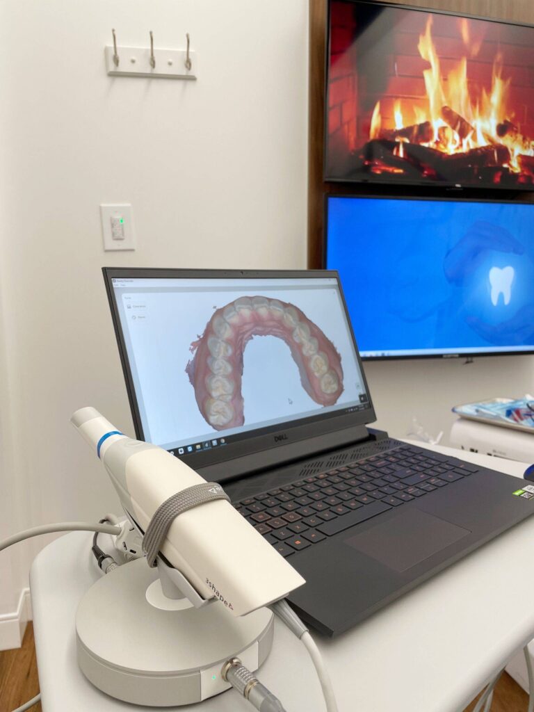 intraoral digital scanner
